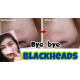 Benzac Blackheads Face Scrub