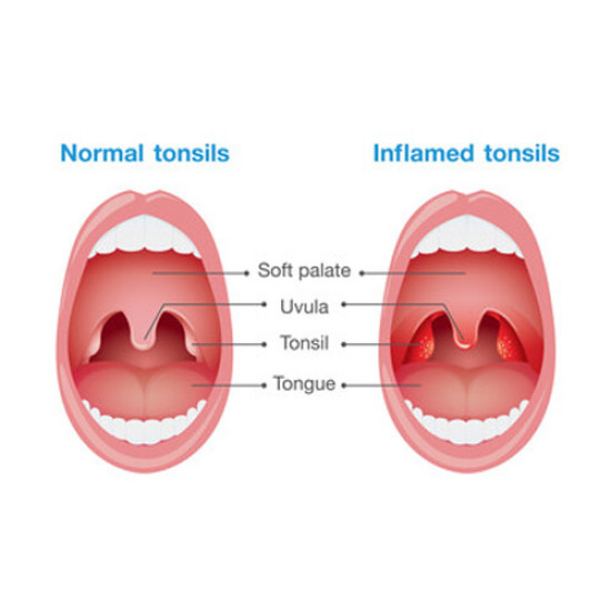 Sanderson Throat FX Gummy Lozenges 60s