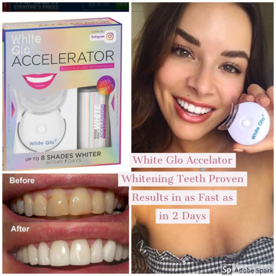 White Glo Accelerator Teeth Whitening Blue Light Kit